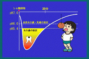 ステファンのカーブ