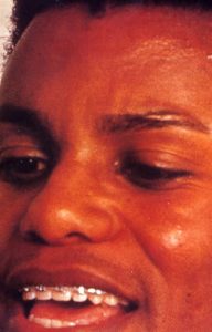 カール・ルイス