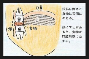 臼歯で噛んだとき