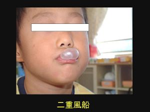 風船ガムを利用た口遊び（二重風船）