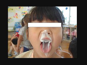 風船ガムを利用た口遊び