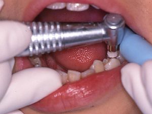 バキュームを引きながらの研磨