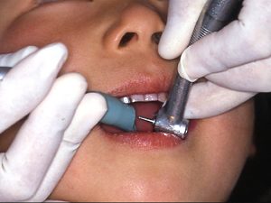 バキュームを引きながらの研磨