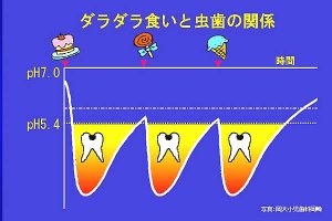 ダラダラ食いと虫歯の関係