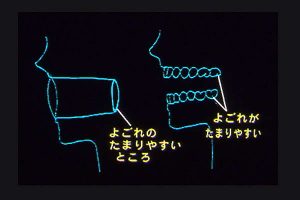 汚れのたまりやすいところ