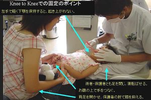 Knee to Kneeでの固定のポイント