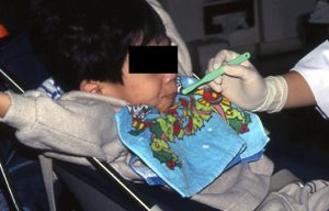 歯ブラシで口唇を触った瞬間